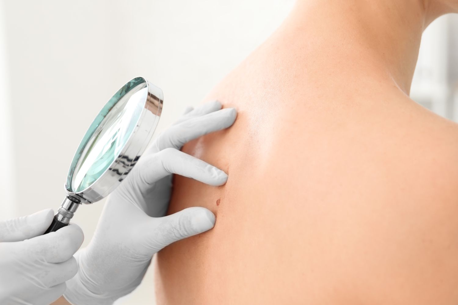 Dermatologia a Domicilio (o direttamente in struttura) 2 Dermatologia a Domicilio (o direttamente in struttura) 1